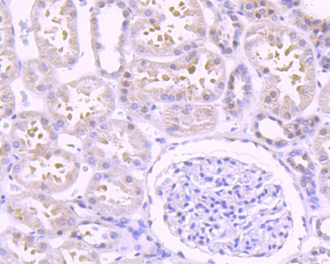 EGFR Antibody in Immunohistochemistry (Paraffin) (IHC (P))