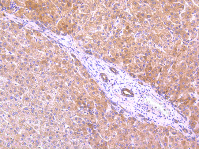 EGFR Antibody in Immunohistochemistry (Paraffin) (IHC (P))