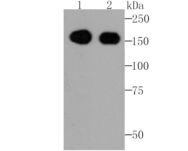 EGFR Antibody in Western Blot (WB)