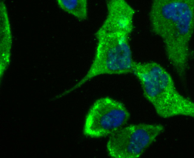 IL-8 Antibody in Immunocytochemistry (ICC/IF)