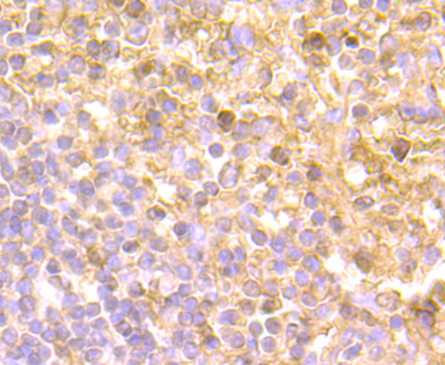 IL-8 Antibody in Immunohistochemistry (Paraffin) (IHC (P))