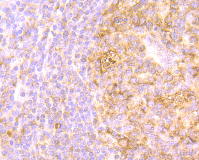 IL-8 Antibody in Immunohistochemistry (Paraffin) (IHC (P))