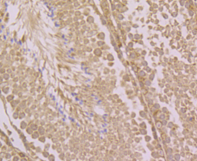 LOXL2 Antibody in Immunohistochemistry (Paraffin) (IHC (P))