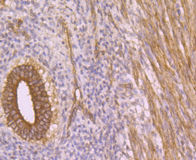 LOXL2 Antibody in Immunohistochemistry (Paraffin) (IHC (P))