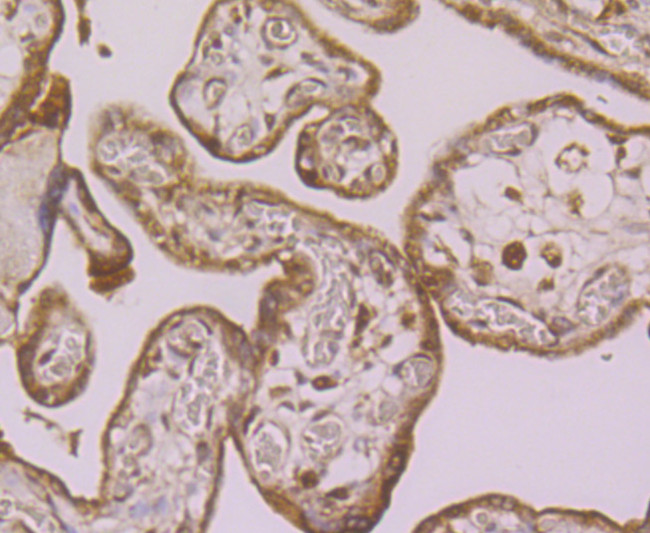 LOXL2 Antibody in Immunohistochemistry (Paraffin) (IHC (P))