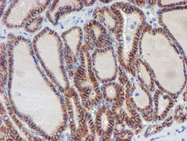 ERBB2 Antibody in Immunohistochemistry (Paraffin) (IHC (P))