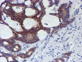 ERBB2 Antibody in Immunohistochemistry (Paraffin) (IHC (P))