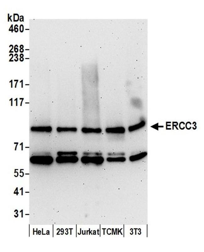 ERCC3 Antibody in Western Blot (WB)
