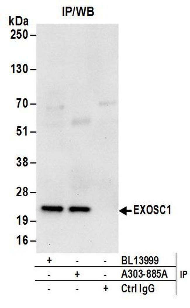 EXOSC1 Antibody in Western Blot (WB)