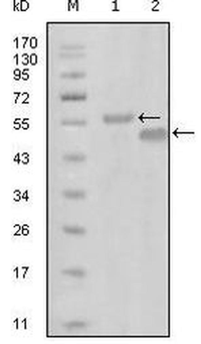 EphA6 Antibody in Western Blot (WB)