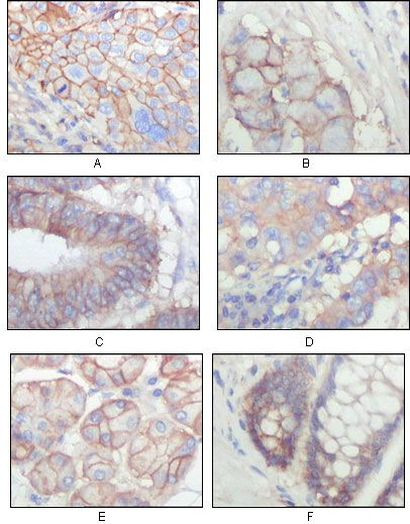 EphB3 Antibody in Immunohistochemistry (Paraffin) (IHC (P))