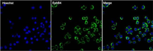 EphB4 Antibody in Immunocytochemistry (ICC/IF)