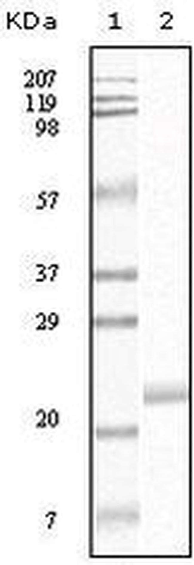 EphB4 Antibody in Western Blot (WB)