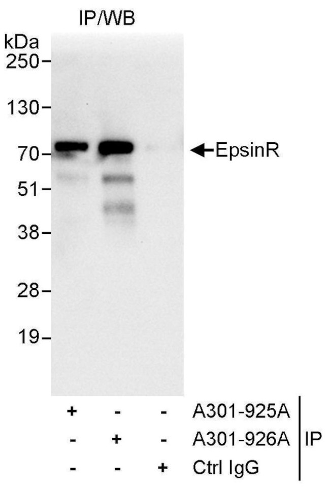 EpsinR Antibody in Immunoprecipitation (IP)