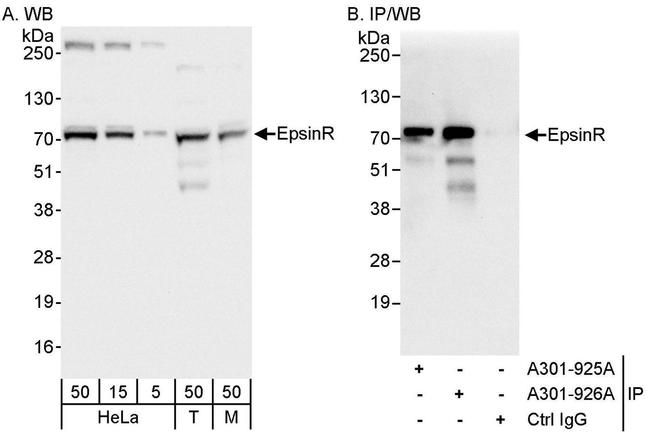 EpsinR Antibody in Western Blot (WB)