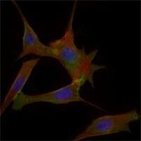 FABP2 Antibody in Immunocytochemistry (ICC/IF)