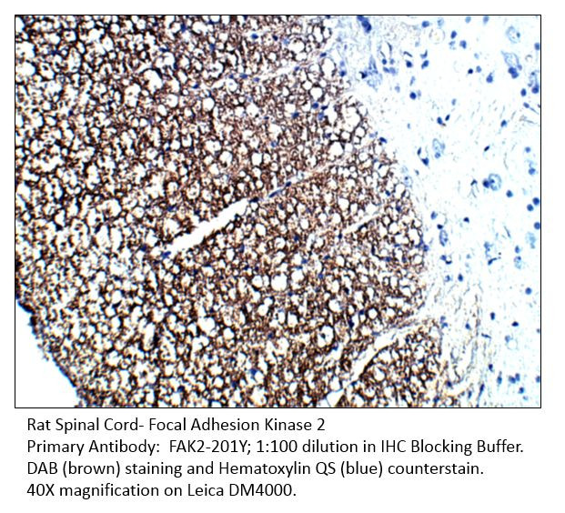 FAK2 Antibody in Immunohistochemistry (IHC)