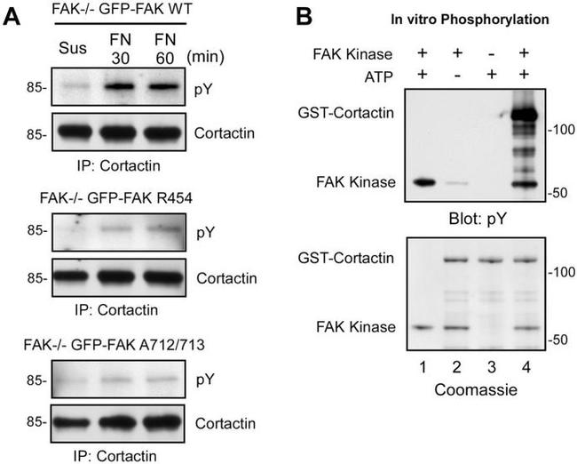 Phospho-FAK (Tyr397) Antibody in Western Blot (WB)