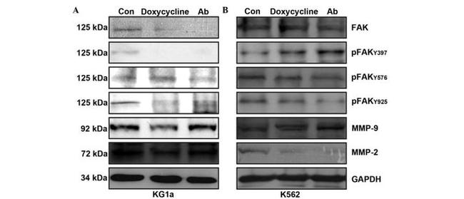 Phospho-FAK (Tyr397) Antibody in Western Blot (WB)