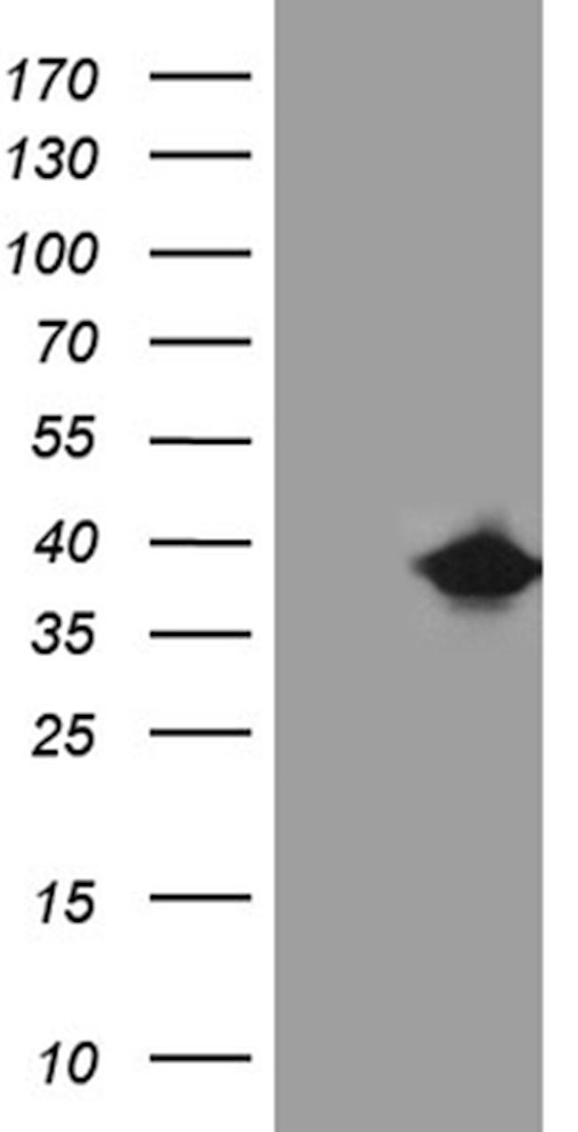 FAM151B Antibody in Western Blot (WB)