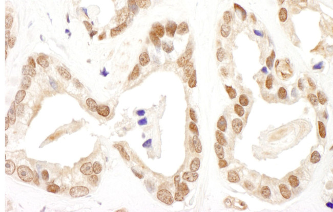 FANCD2 Antibody in Immunohistochemistry (IHC)