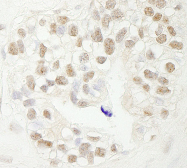 FBW7 Antibody in Immunohistochemistry (IHC)