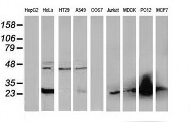 FHL1 Antibody in Western Blot (WB)