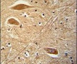 FIBB Antibody in Immunohistochemistry (IHC)