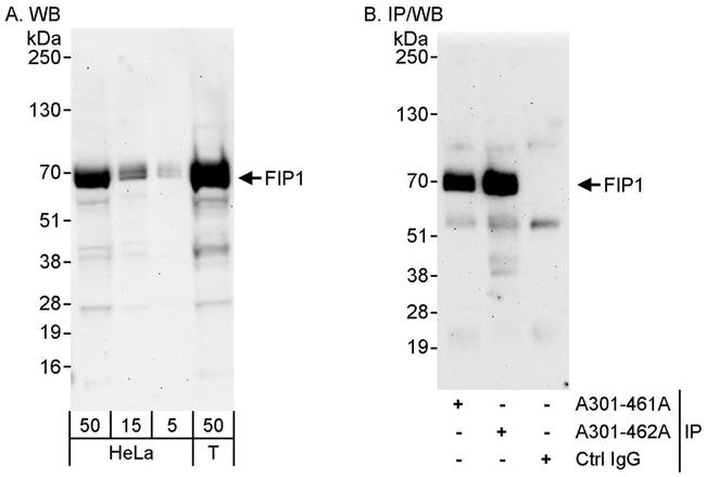 FIP1 Antibody in Western Blot (WB)