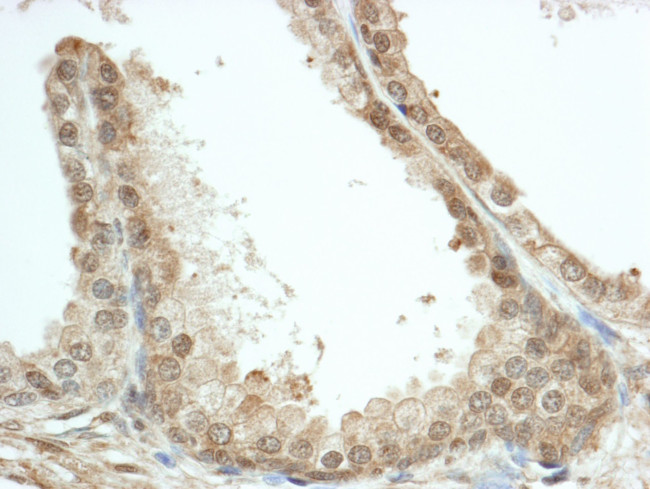 FKBP4/FKBP52 Antibody in Immunohistochemistry (IHC)