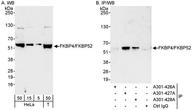 FKBP4/FKBP52 Antibody in Western Blot (WB)