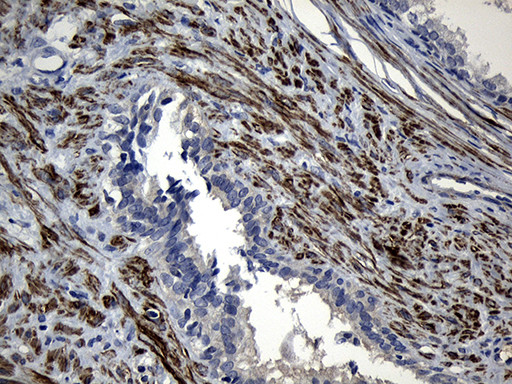 FLJ33360 Antibody in Immunohistochemistry (Paraffin) (IHC (P))