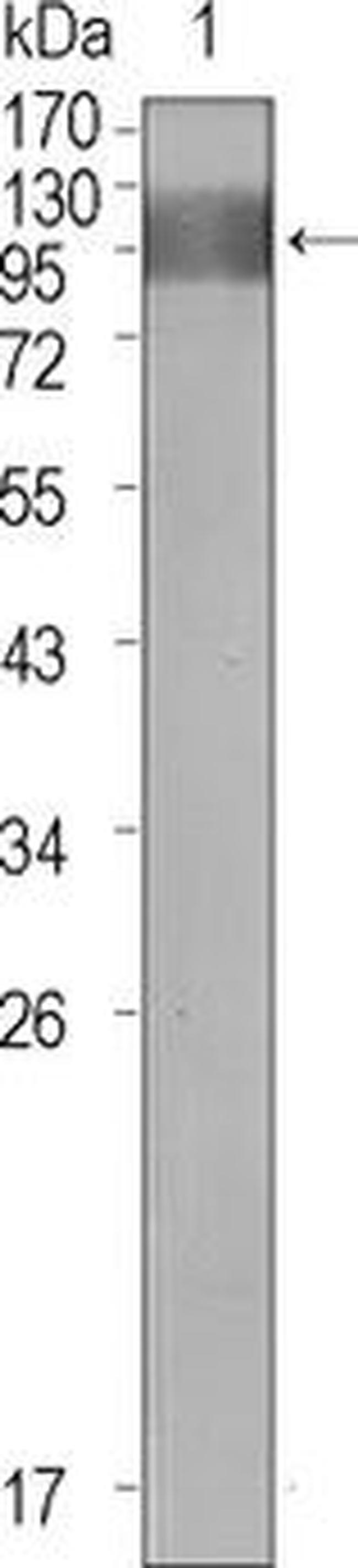 VEGF Receptor 1 Antibody in Western Blot (WB)