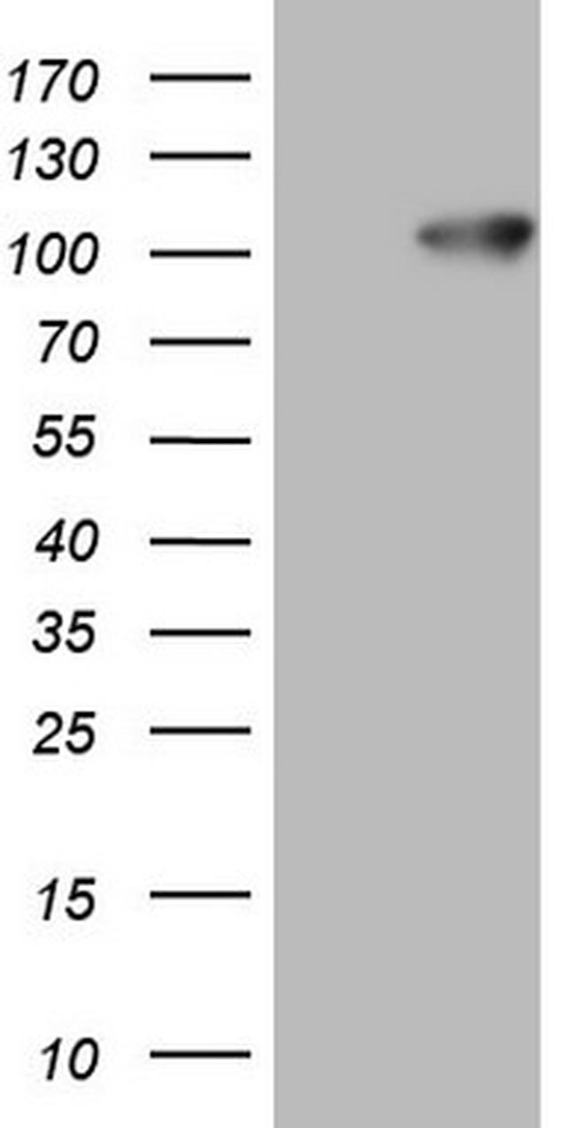 FSIP1 Antibody in Western Blot (WB)