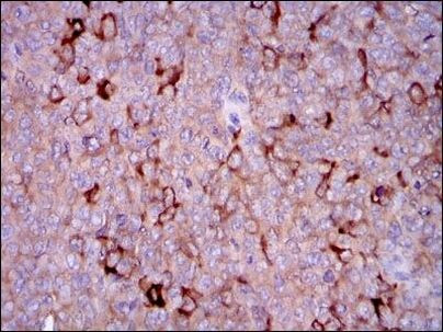 G6PD Antibody in Immunohistochemistry (Paraffin) (IHC (P))