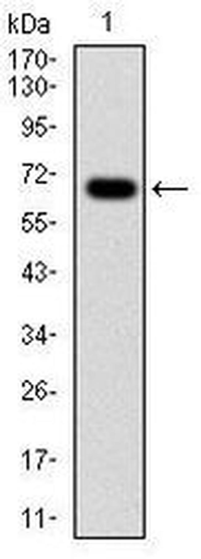 G6PD Antibody in Western Blot (WB)