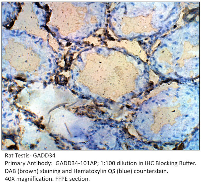 GADD34 Antibody in Immunohistochemistry (IHC)