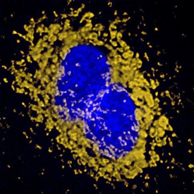 Mouse IgG (H+L) Highly Cross-Adsorbed Secondary Antibody in Immunocytochemistry (ICC/IF)