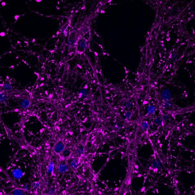 Rabbit IgG (H+L) Highly Cross-Adsorbed Secondary Antibody in Immunocytochemistry (ICC/IF)