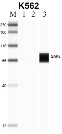 GARS Antibody in Immunoprecipitation (IP)