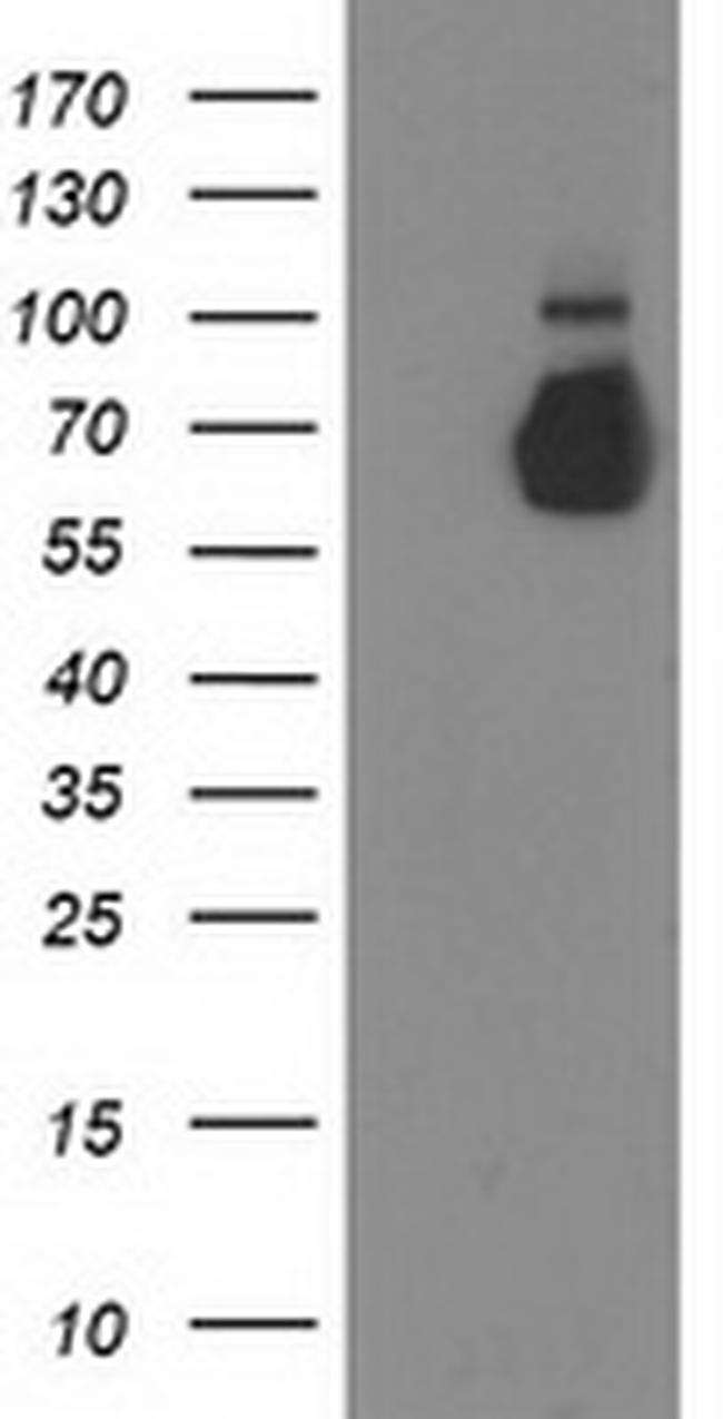 GBP5 Antibody in Western Blot (WB)