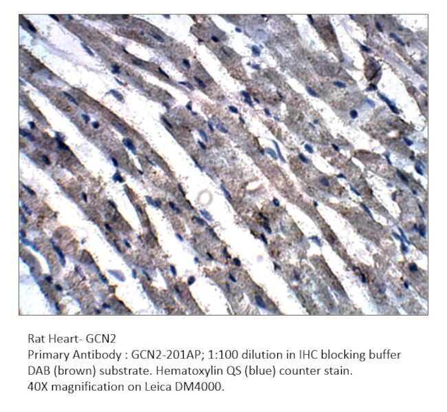 GCN2 Antibody in Immunohistochemistry (IHC)