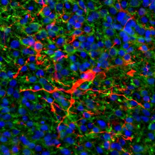 GFAP Antibody in Immunocytochemistry (ICC/IF)