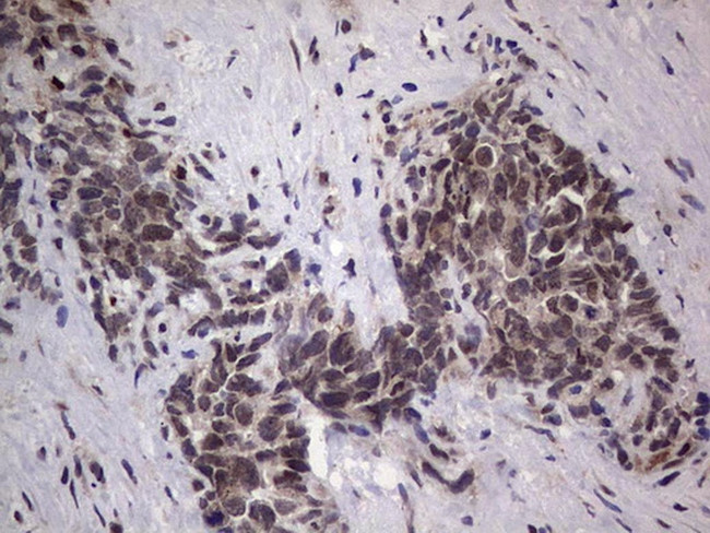 GLI2 Antibody in Immunohistochemistry (Paraffin) (IHC (P))