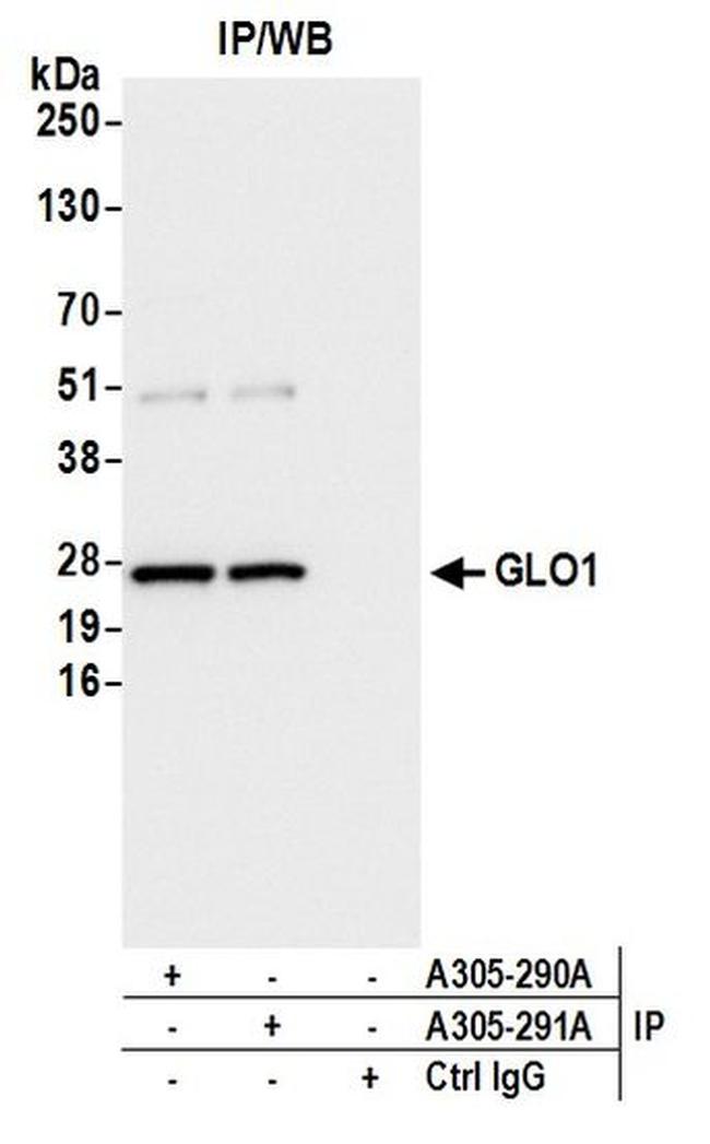 GLO1/Glyoxalase I Antibody in Western Blot (WB)