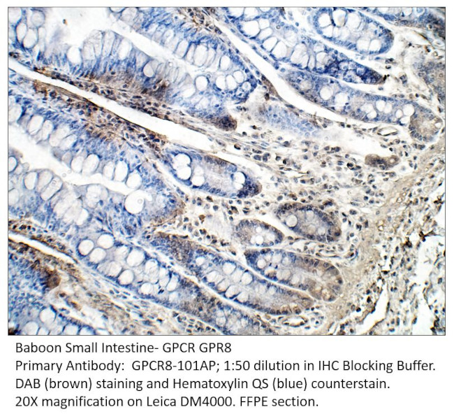 GPCR GPR8 Antibody in Immunohistochemistry (IHC)