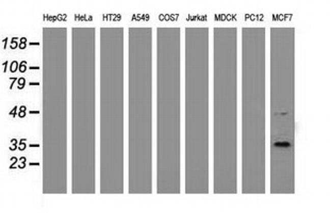 GRHPR Antibody in Western Blot (WB)