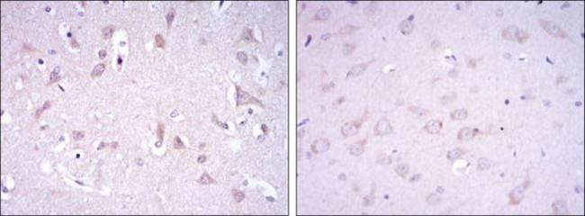 GluR3 Antibody in Immunohistochemistry (Paraffin) (IHC (P))