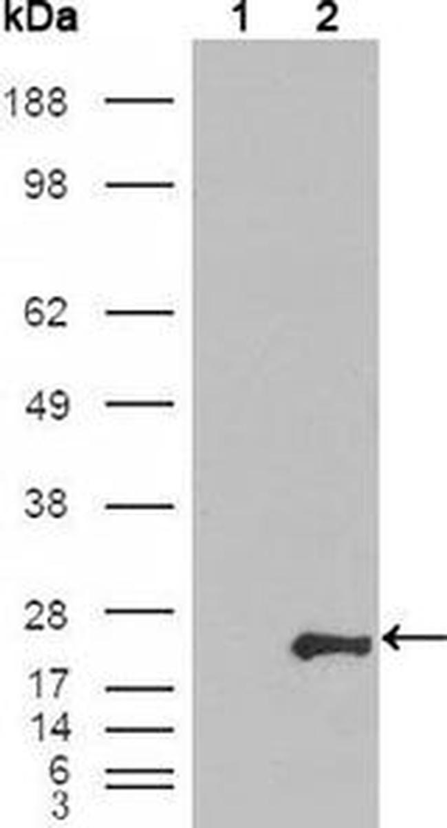GSTP1 Antibody in Western Blot (WB)
