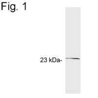 GCAP2 Antibody in Western Blot (WB)